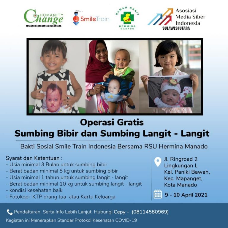 Smile Train Indonesia, RSU Hermina Manado dan AMSI Sulut Gelar Operasi Bibir Sumbing