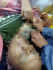 Meninggalnya Warga Toruakat di Lokasi PT BDL, Irawan: Tak Ada Antisipasi Dari Polres Bolmong